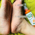 Revitalize Your Skin with 110ML Foot Peeling Spray - Perfect for Smoother Elbows, Knees, and More!