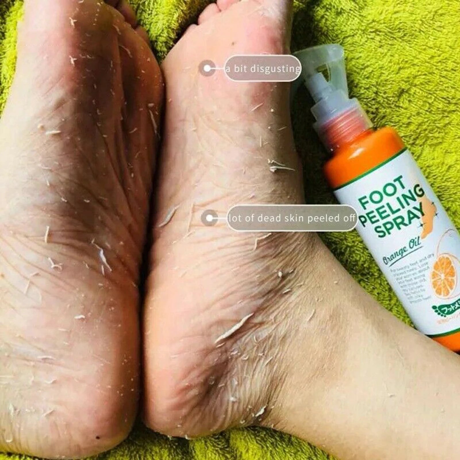 Revitalize Your Skin with 110ML Foot Peeling Spray - Perfect for Smoother Elbows, Knees, and More!